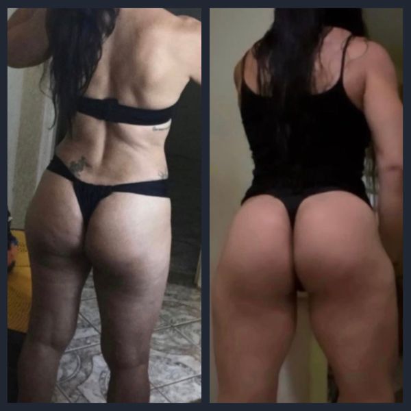 Antes e depois